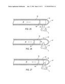 TISSUE REMOVAL DEVICE FOR NEUROSURGICAL AND SPINAL SURGERY APPLICATIONS diagram and image