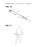 PROCESSING SENSED ACCELEROMETER DATA FOR DETERMINATION OF BONE HEALING diagram and image