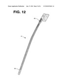 PROCESSING SENSED ACCELEROMETER DATA FOR DETERMINATION OF BONE HEALING diagram and image