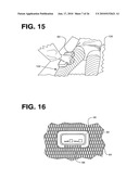 PROCESSING SENSED ACCELEROMETER DATA FOR DETERMINATION OF BONE HEALING diagram and image