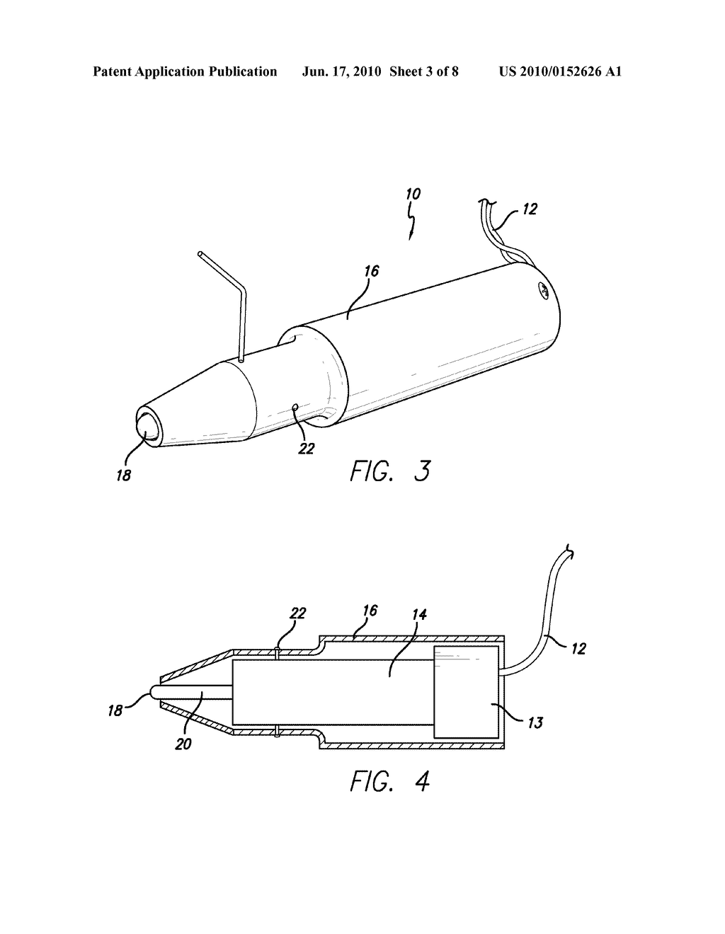 ULTRASONIC TREATMENT OF GLAUCOMA - diagram, schematic, and image 04