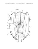 Heel Ulcer Prevention and Cushioning Boot diagram and image