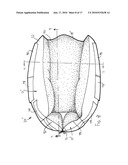 Heel Ulcer Prevention and Cushioning Boot diagram and image