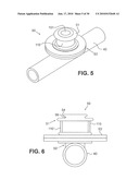 METHODS AND APPARATUS FOR VASCULAR ACCESS diagram and image