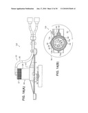 METHODS AND APPARATUS FOR VASCULAR ACCESS diagram and image