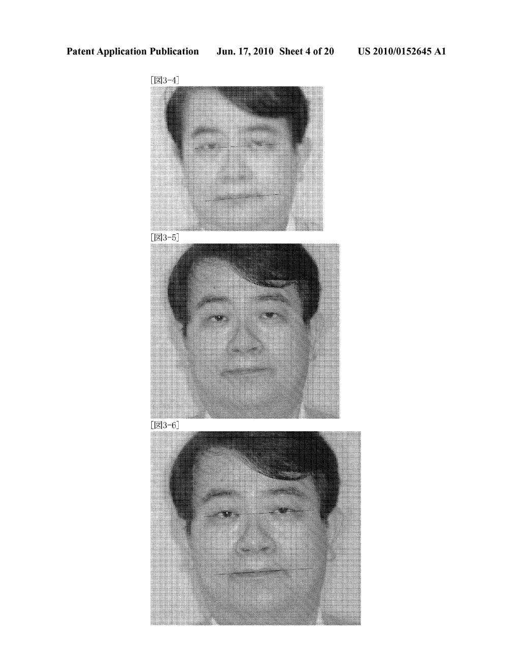 Facial Hair-Growth Device and Facial Hair-Growth System - diagram, schematic, and image 05