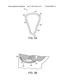 Feminine undergarment diagram and image