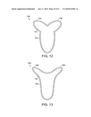 Feminine undergarment diagram and image