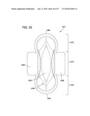 ABSORBENT ARTICLE HAVING LINE OF WEAKNESS FOR FOLDING THE ARTICLE diagram and image