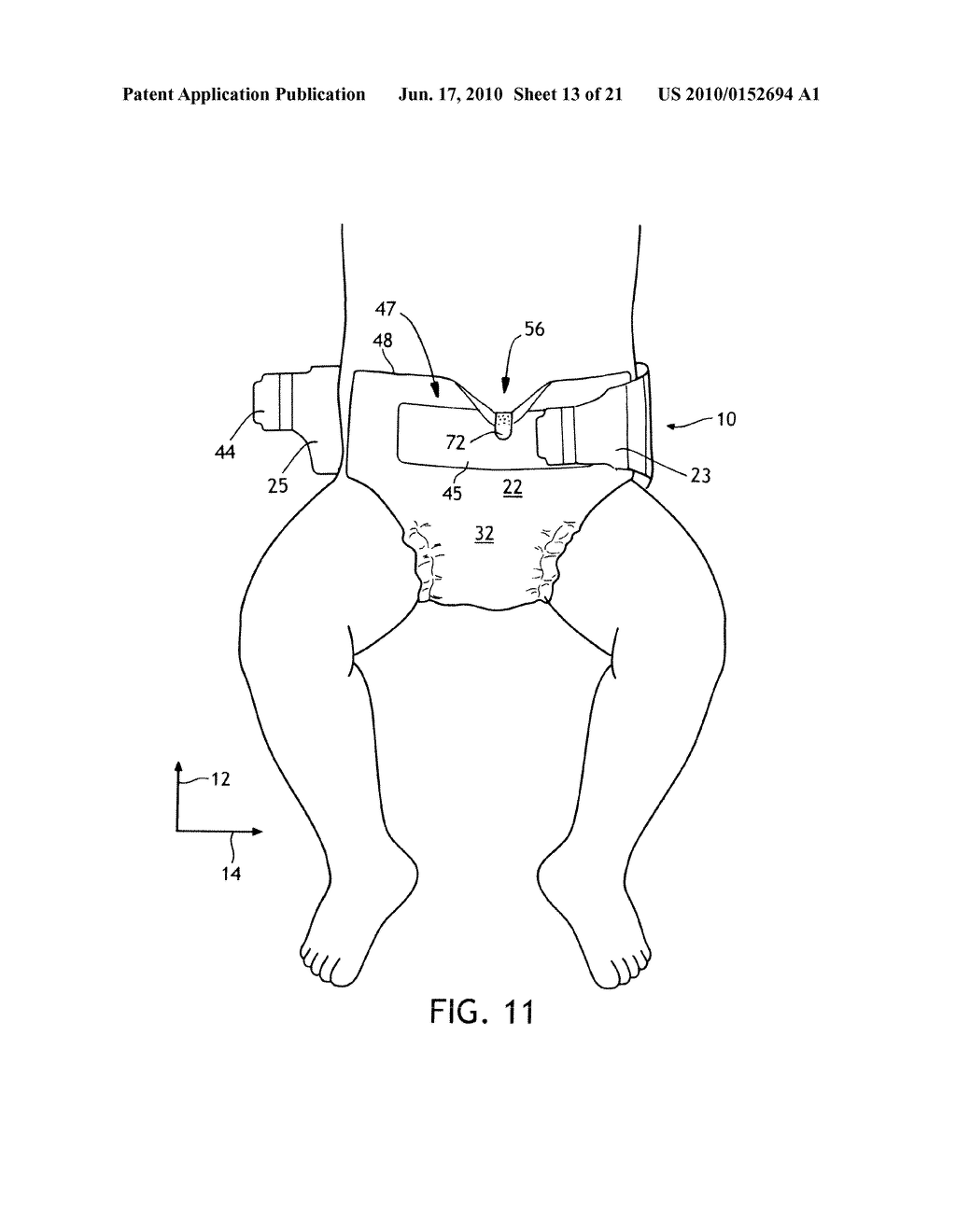 Absorbent article with waist relief feature - diagram, schematic, and image 14