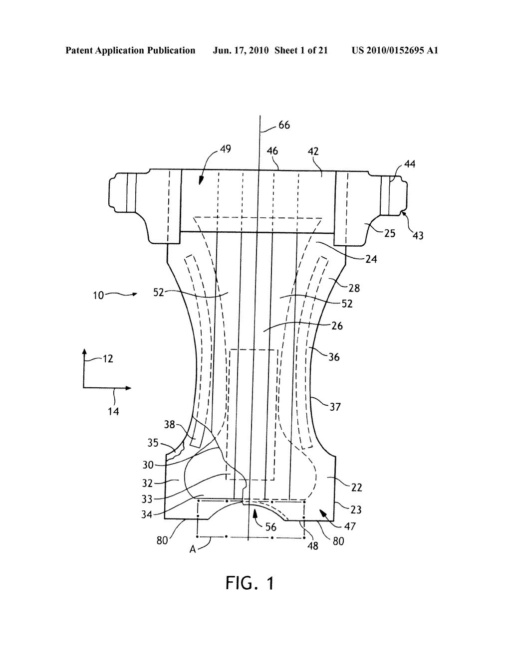 Method for making a waist relief feature - diagram, schematic, and image 02