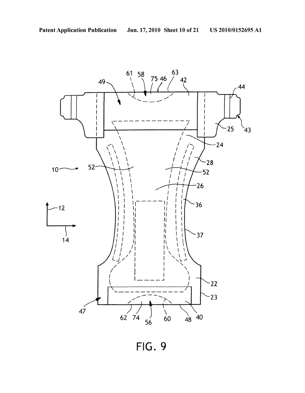 Method for making a waist relief feature - diagram, schematic, and image 11