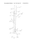 Dysfunction Resistant Catheter Systems and Associated Methods diagram and image