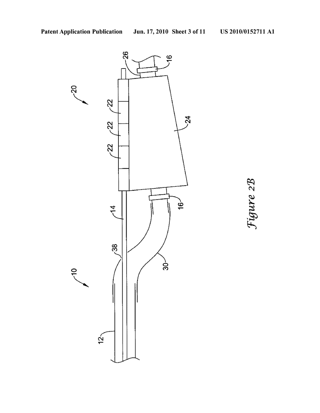 OFFSET COUPLING REGION - diagram, schematic, and image 04