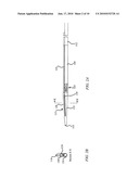 OFFSET CATHETER diagram and image