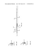 OFFSET CATHETER diagram and image