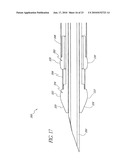 METHODS AND APPARATUS FOR COAGULATING AND/OR CONSTRICTING HOLLOW ANATOMICAL STRUCTURES diagram and image