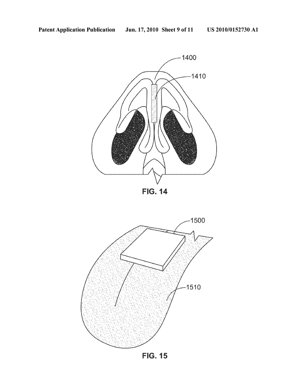 MUCOSAL TISSUE DRESSING AND METHOD OF USE - diagram, schematic, and image 10