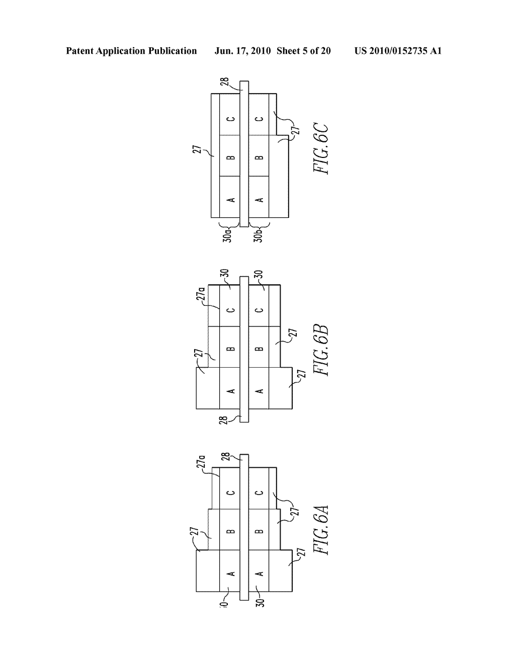 SYSTEMS AND METHODS FOR INSTALLING AND REMOVING AN EXPANDABLE POLYMER - diagram, schematic, and image 06