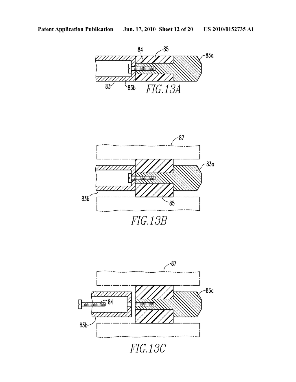 SYSTEMS AND METHODS FOR INSTALLING AND REMOVING AN EXPANDABLE POLYMER - diagram, schematic, and image 13