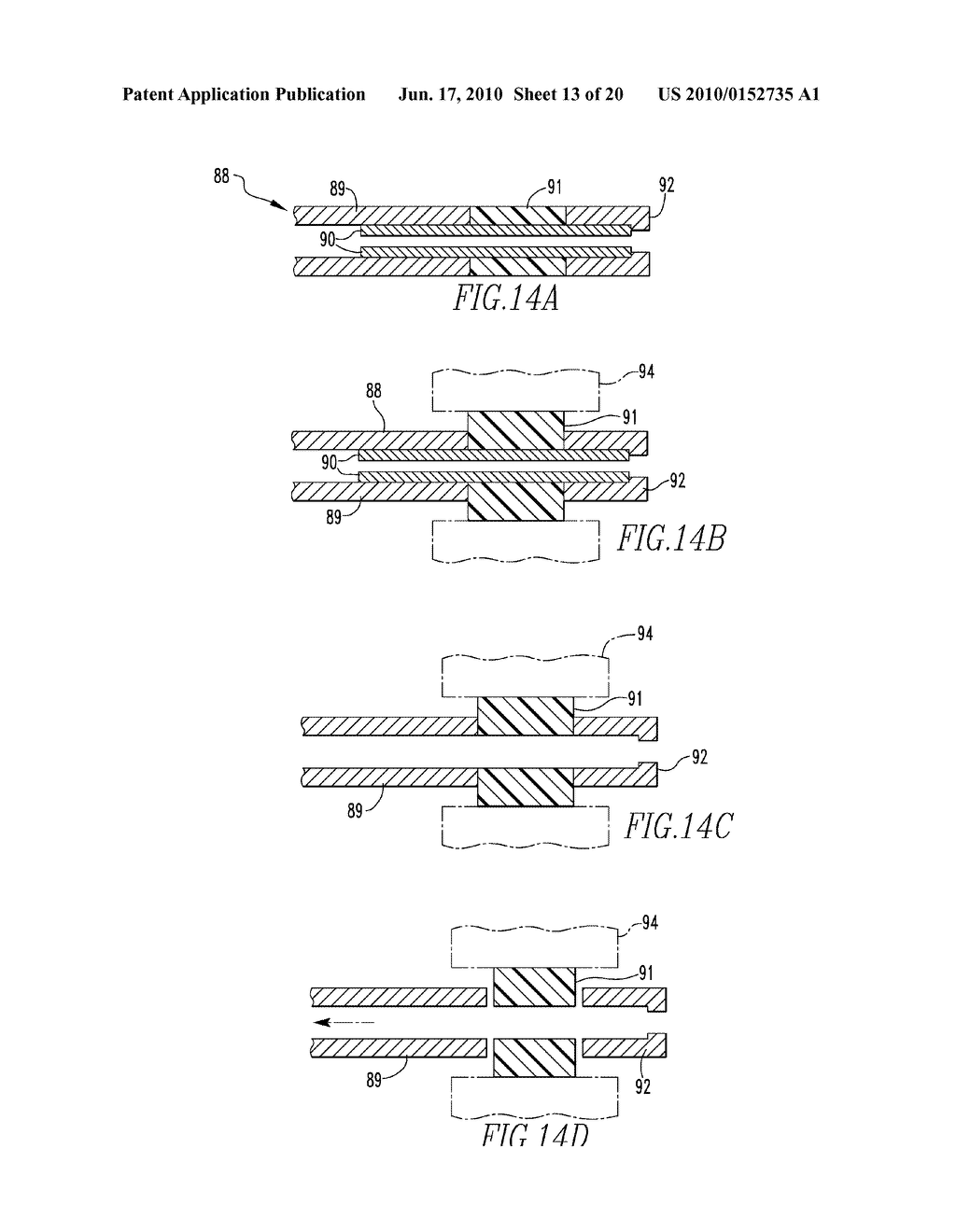 SYSTEMS AND METHODS FOR INSTALLING AND REMOVING AN EXPANDABLE POLYMER - diagram, schematic, and image 14