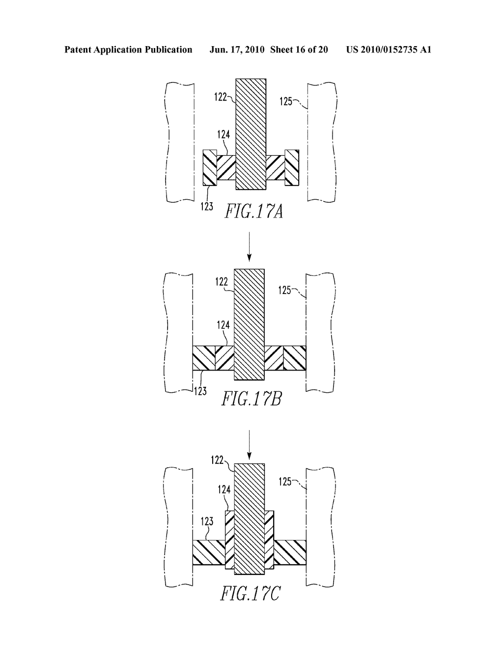 SYSTEMS AND METHODS FOR INSTALLING AND REMOVING AN EXPANDABLE POLYMER - diagram, schematic, and image 17