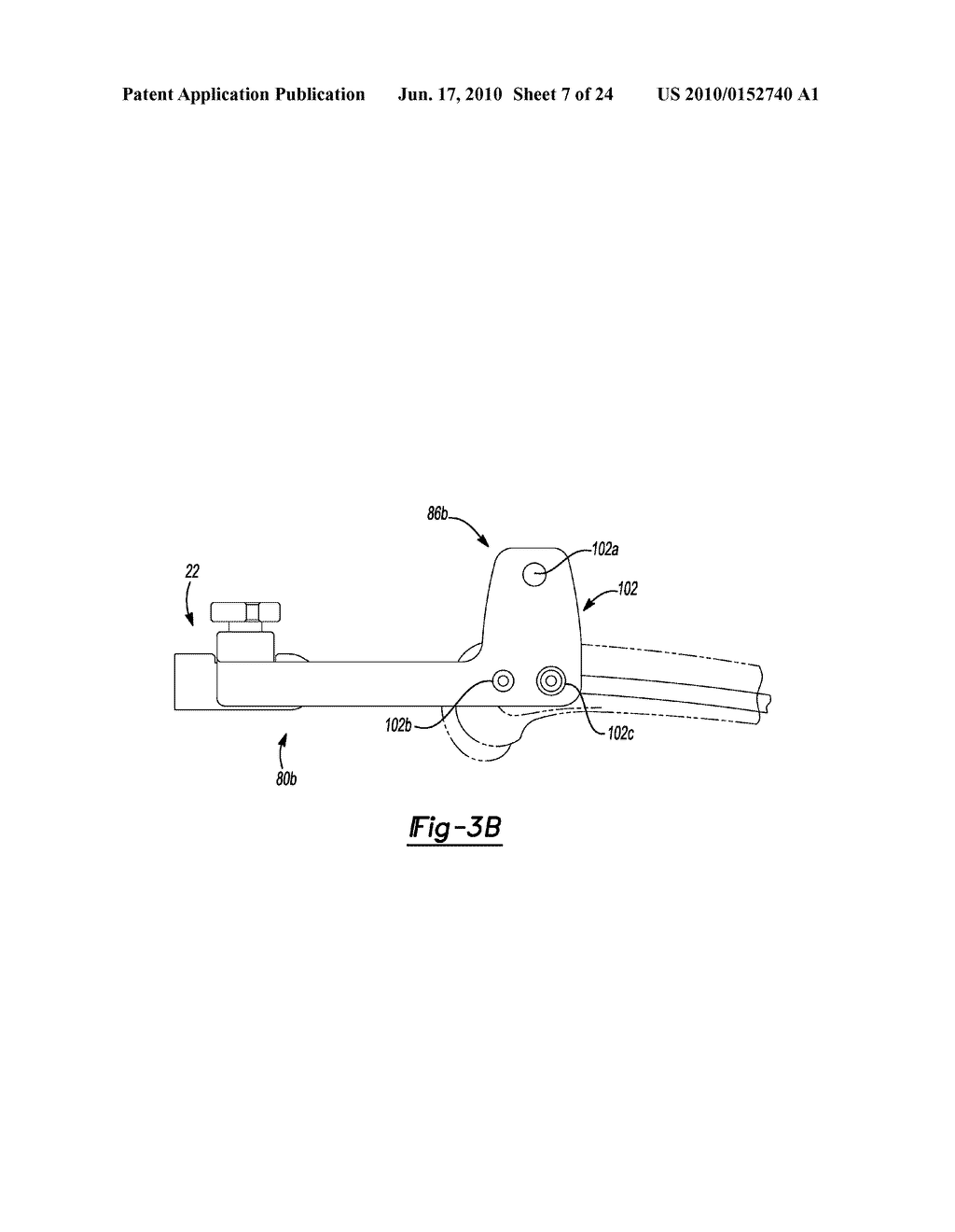 METHOD AND APPARATUS FOR ORTHOPEDIC FIXATION - diagram, schematic, and image 08