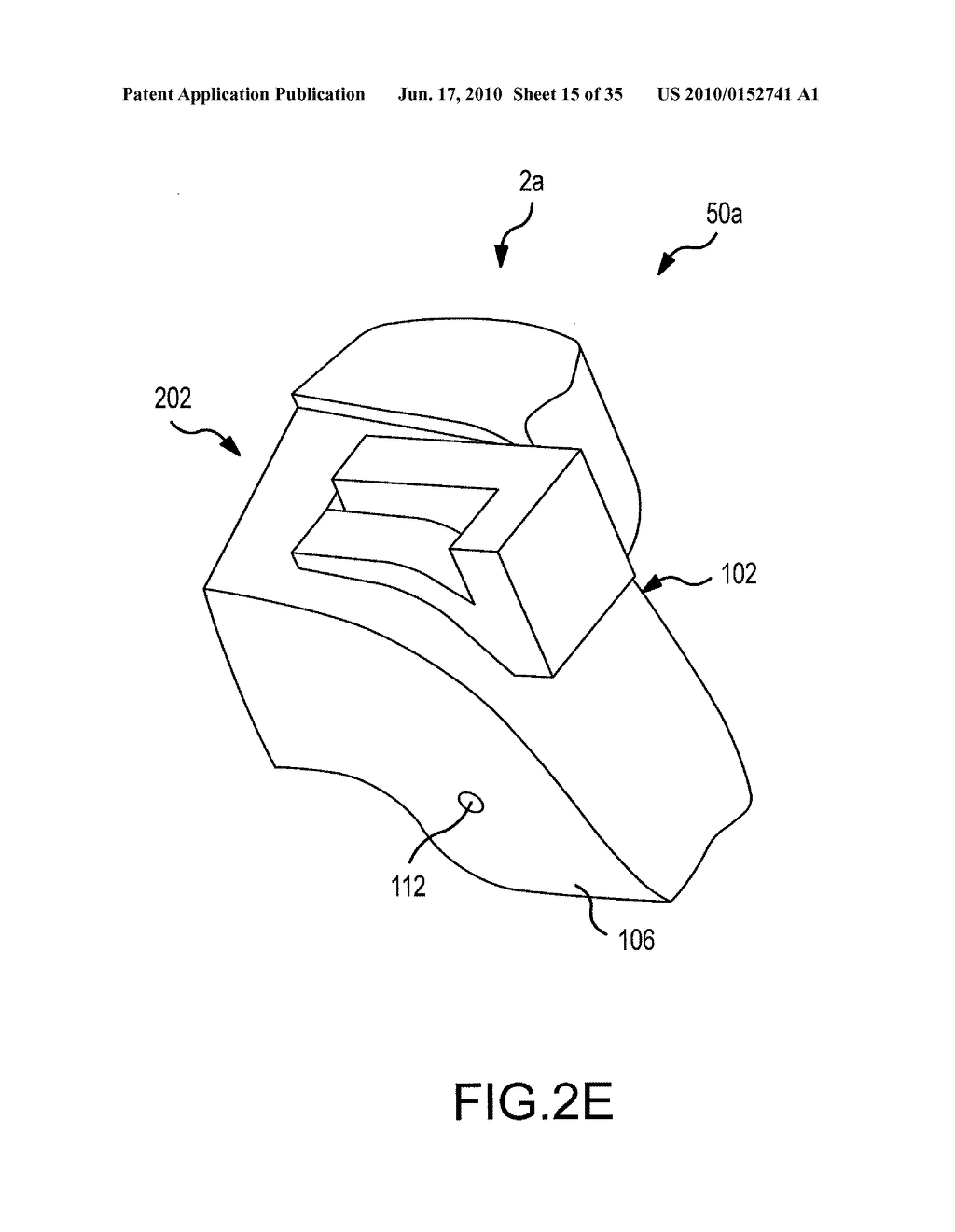 UNICOMPARTMENTAL CUSTOMIZED ARTHROPLASTY CUTTING JIGS AND METHODS OF MAKING THE SAME - diagram, schematic, and image 16