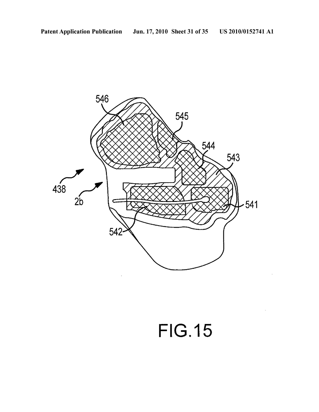 UNICOMPARTMENTAL CUSTOMIZED ARTHROPLASTY CUTTING JIGS AND METHODS OF MAKING THE SAME - diagram, schematic, and image 32