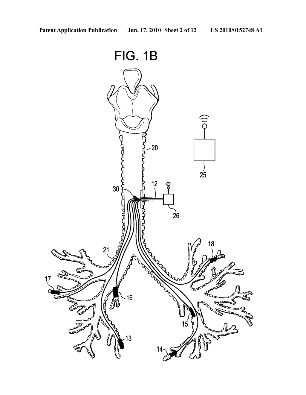 Devices, Systems, and Methods Providing Body Lumen Access - diagram, schematic, and image 03