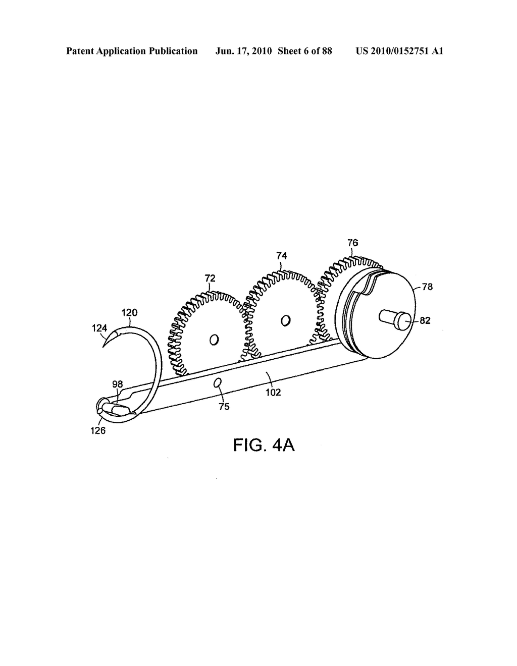 Apparatus and method for minimally invasive suturing - diagram, schematic, and image 07