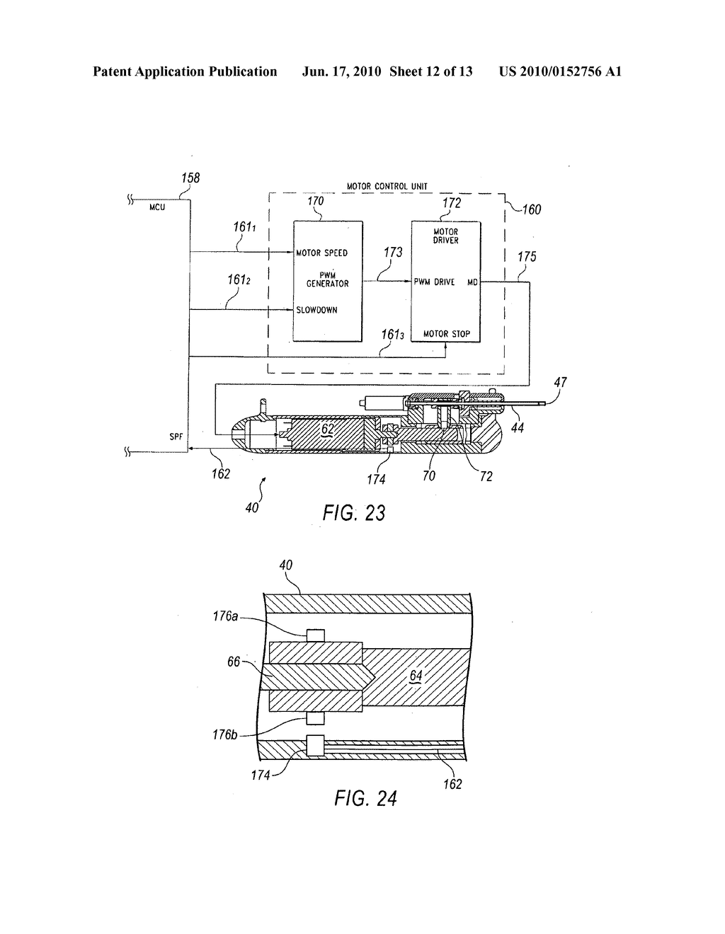 TISSUE REMOVAL DEVICE FOR NEUROSURGICAL AND SPINAL SURGERY APPLICATIONS - diagram, schematic, and image 13