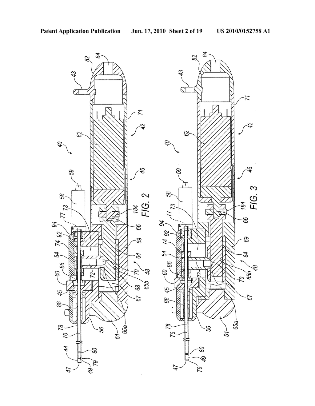 TISSUE REMOVAL DEVICE FOR NEUROSURGICAL AND SPINAL SURGERY APPLICATIONS - diagram, schematic, and image 03