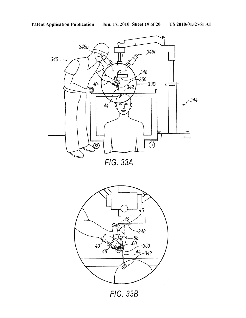 TISSUE REMOVAL DEVICE FOR NEUROSURGICAL AND SPINAL SURGERY APPLICATIONS - diagram, schematic, and image 20