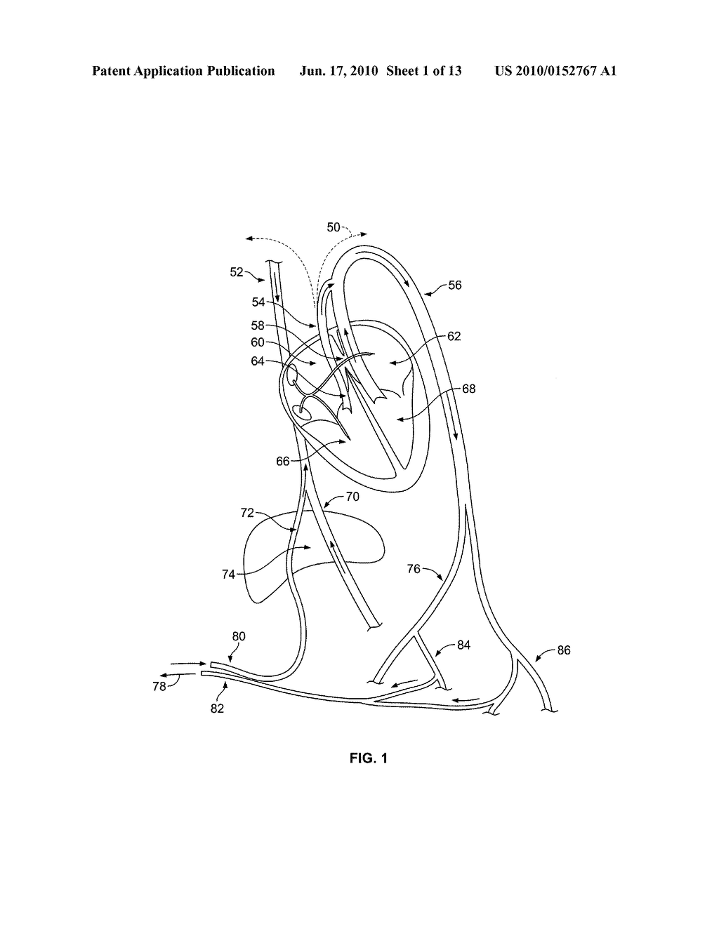 Mechanical Tissue Device and Method - diagram, schematic, and image 02