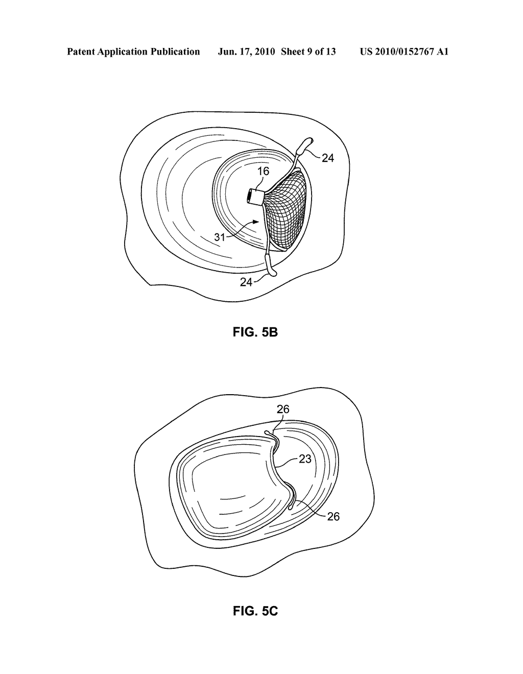 Mechanical Tissue Device and Method - diagram, schematic, and image 10