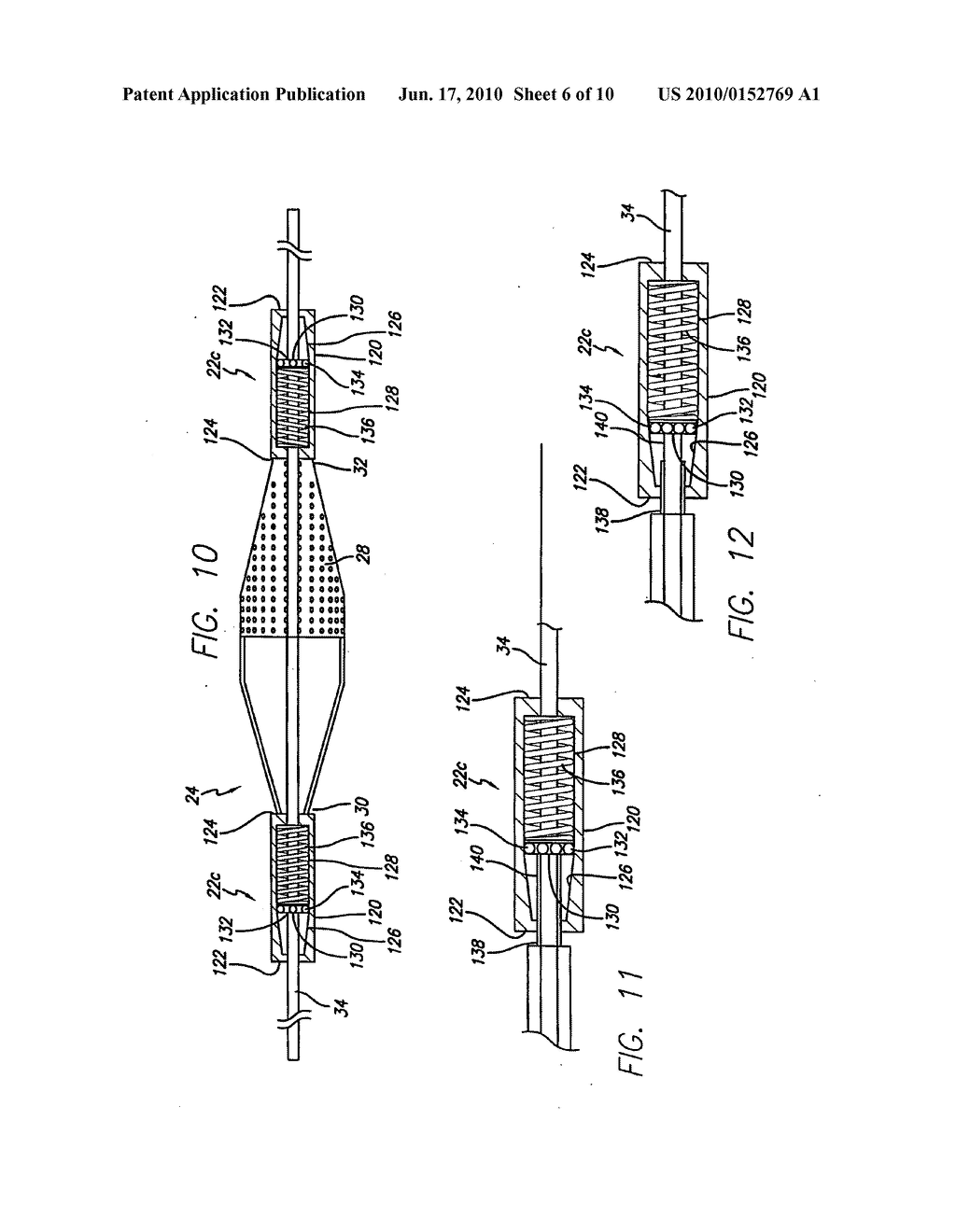 LOCKING COMPONENT FOR AN EMBOLIC FILTER ASSEMBLY - diagram, schematic, and image 07