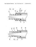 LOCKING COMPONENT FOR AN EMBOLIC FILTER ASSEMBLY diagram and image