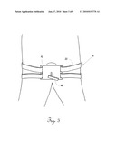 Truncal Tourniquet System & Method diagram and image