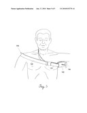 Truncal Tourniquet System & Method diagram and image