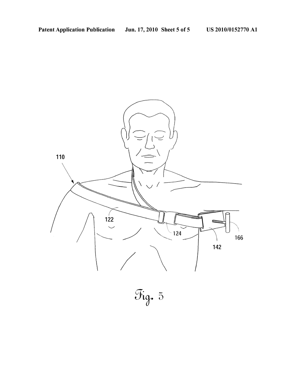 Truncal Tourniquet System & Method - diagram, schematic, and image 06