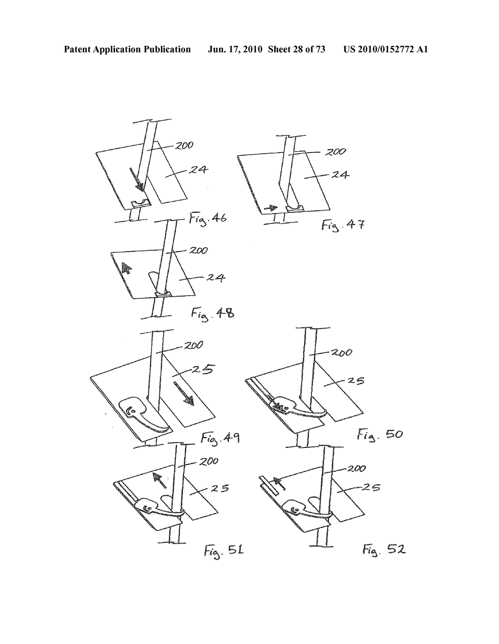 INTERVENTIONAL MEDICAL CLOSURE DEVICE - diagram, schematic, and image 29