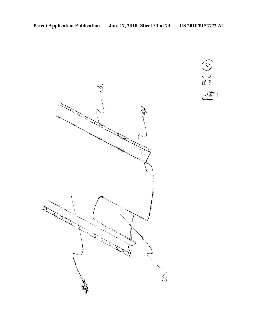 INTERVENTIONAL MEDICAL CLOSURE DEVICE - diagram, schematic, and image 32