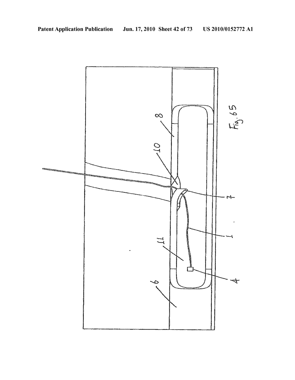 INTERVENTIONAL MEDICAL CLOSURE DEVICE - diagram, schematic, and image 43