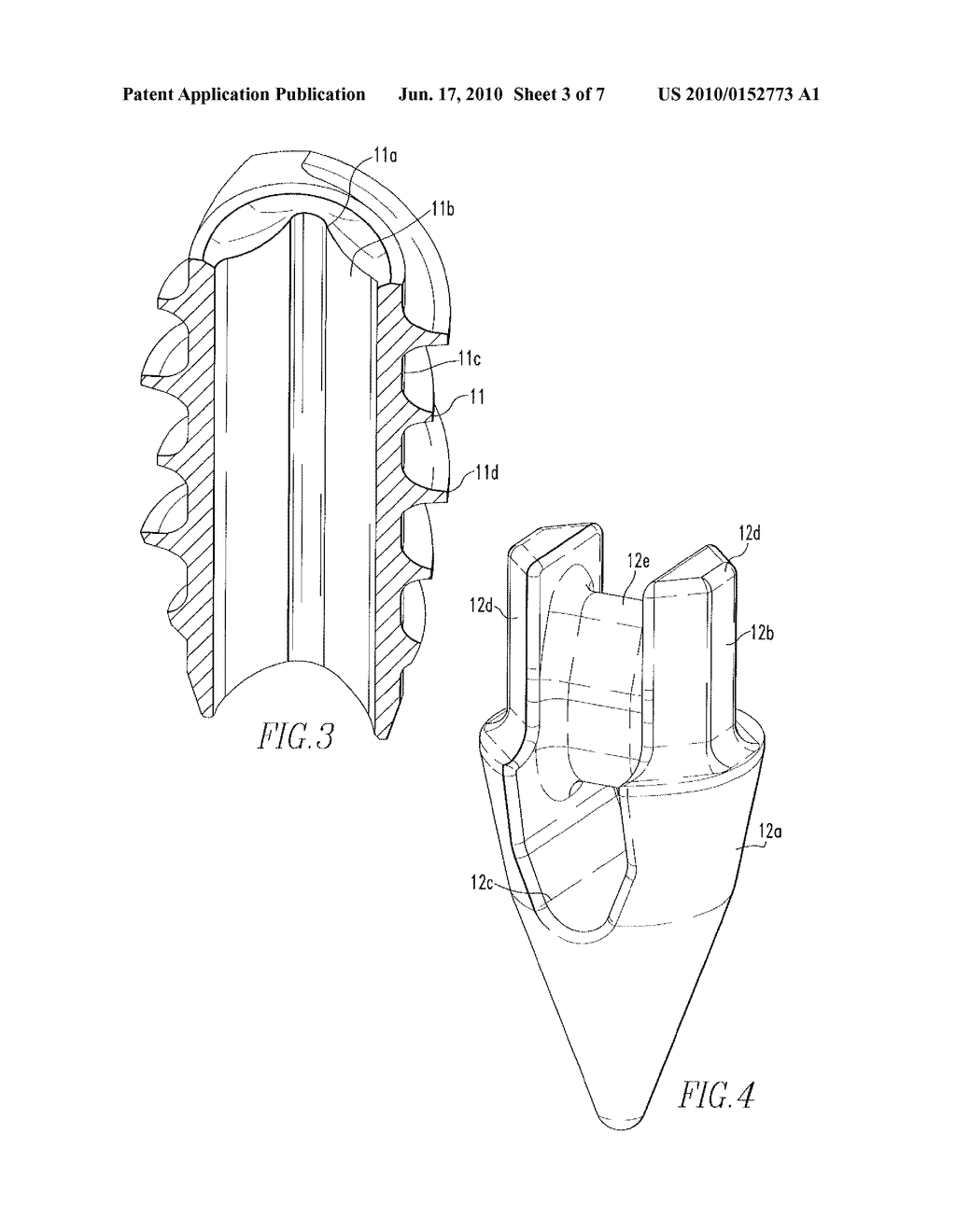 Composite Anchor - diagram, schematic, and image 04