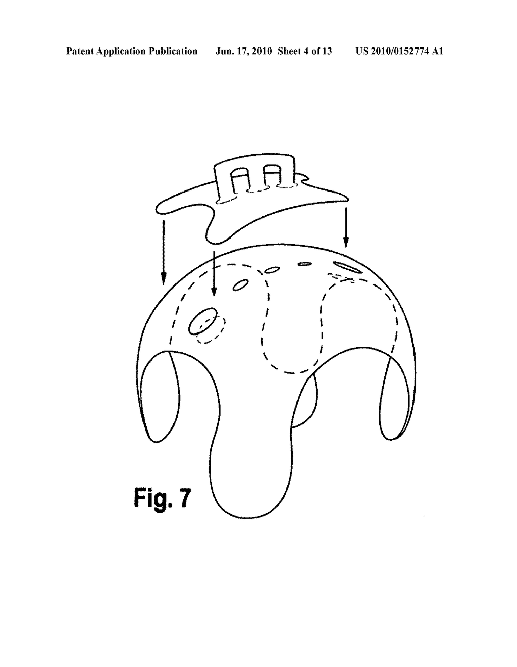 Pacifier/ protection from all surfaces - diagram, schematic, and image 05