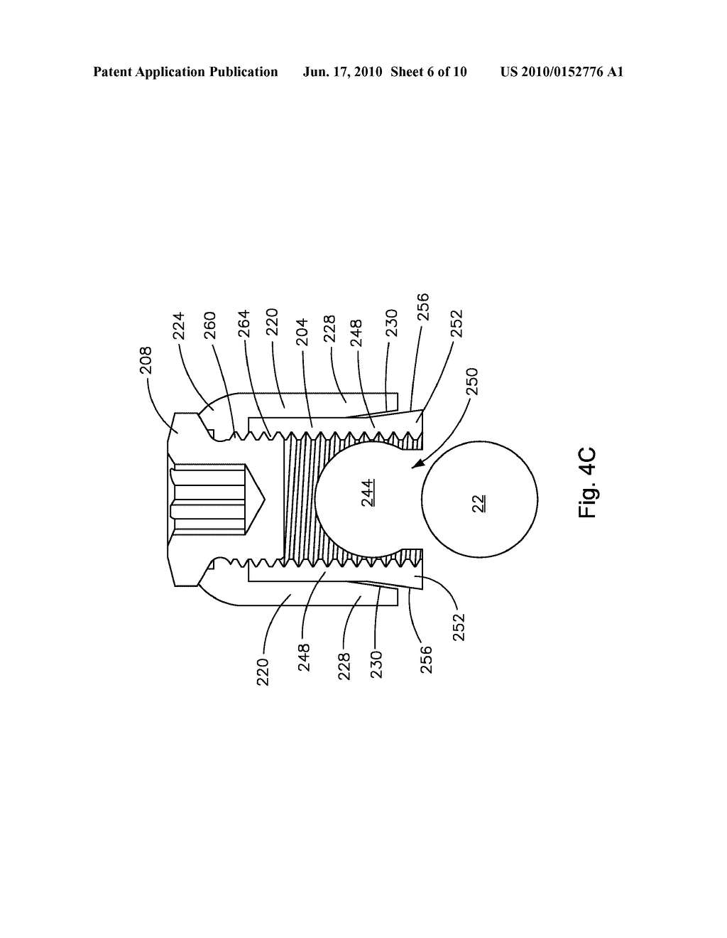 POSTERIOR SPINE DYNAMIC STABILIZER - diagram, schematic, and image 07