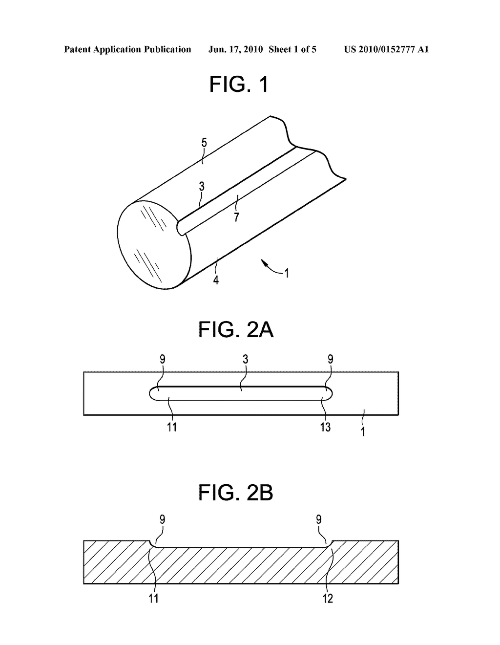 Anti-Infective Spinal Rod with Surface Features - diagram, schematic, and image 02