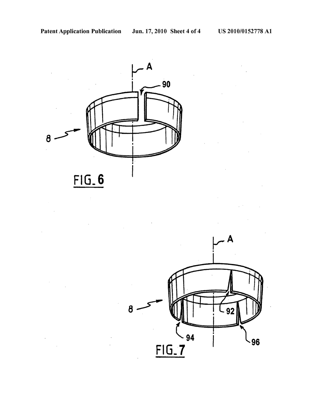 Anchoring member with safety ring - diagram, schematic, and image 05