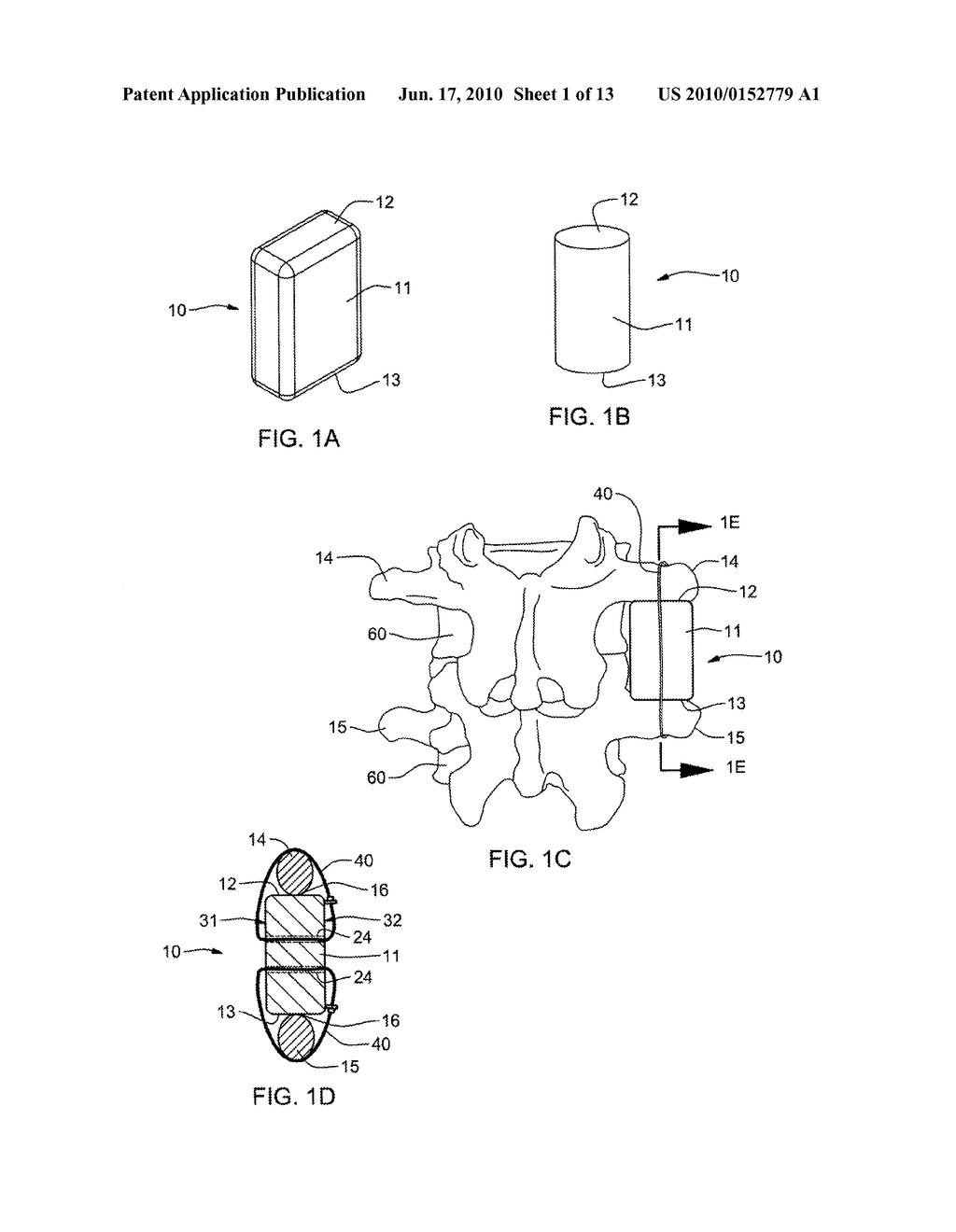 INTER-TRANSVERSE PROCESS SPACER DEVICE AND METHOD FOR USE IN CORRECTING A SPINAL DEFORMITY - diagram, schematic, and image 02